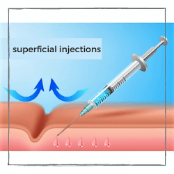 injections of vitamins into the skin