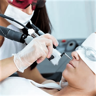 laser hair removal on face 